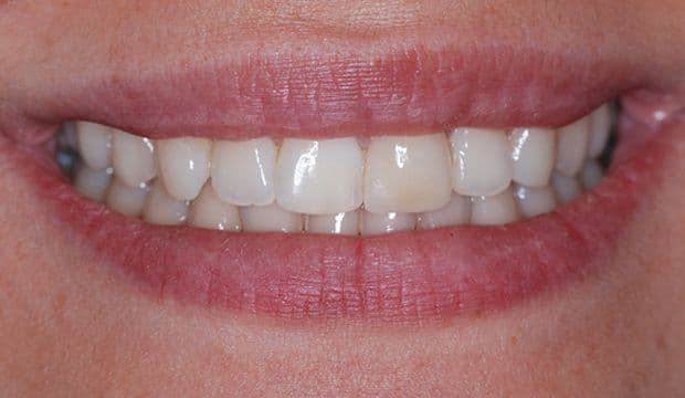 Aesthetic treatment needed at Dental Clinic London