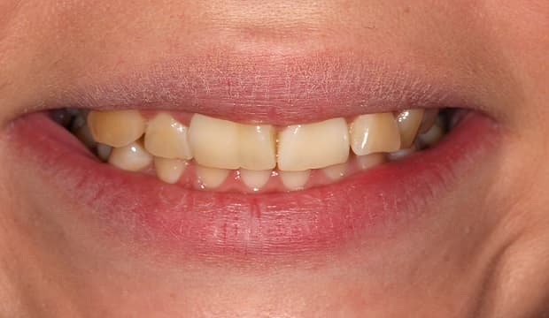 Before